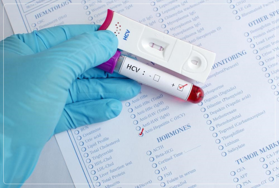 Ảnh test 123